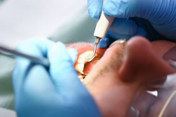 Best Pediatric Emergency Dentist in Lake Nacimiento, CA