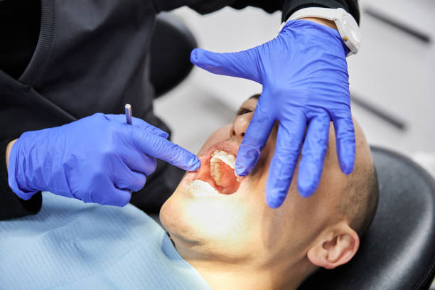 Best Emergency Treatment for Toothache in Lake Nacimiento, CA